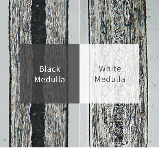 Black Medulla White Medulla