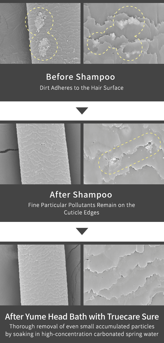 Before shampooing: Dirt adheres to the hair surface  After shampooing: Fine particles of dirt remain on the edge  After [Yume Head Bath Truecare sure]: Highly-concentrated carbonated water soaking removes even fine particles of dirt.