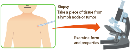 Testing for malignant lymphoma